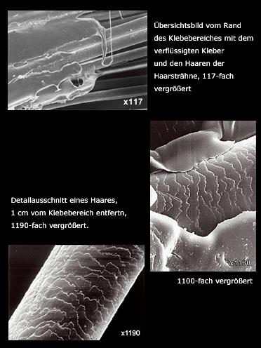 Mikroskopaufnahmen (© www.greatlengths.de)
